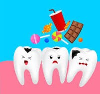 दाँतको खाडल (क्याभिटी) कसरी थाहा पाउने?